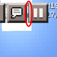 (Zoomed) Normal.jpg